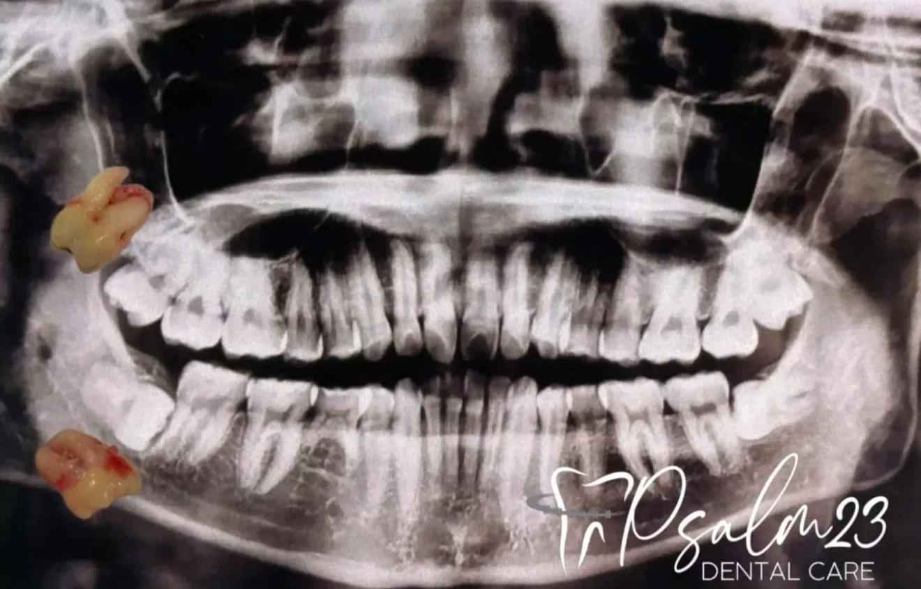 Psalm23 Dental Care oral surgery services — photo 4